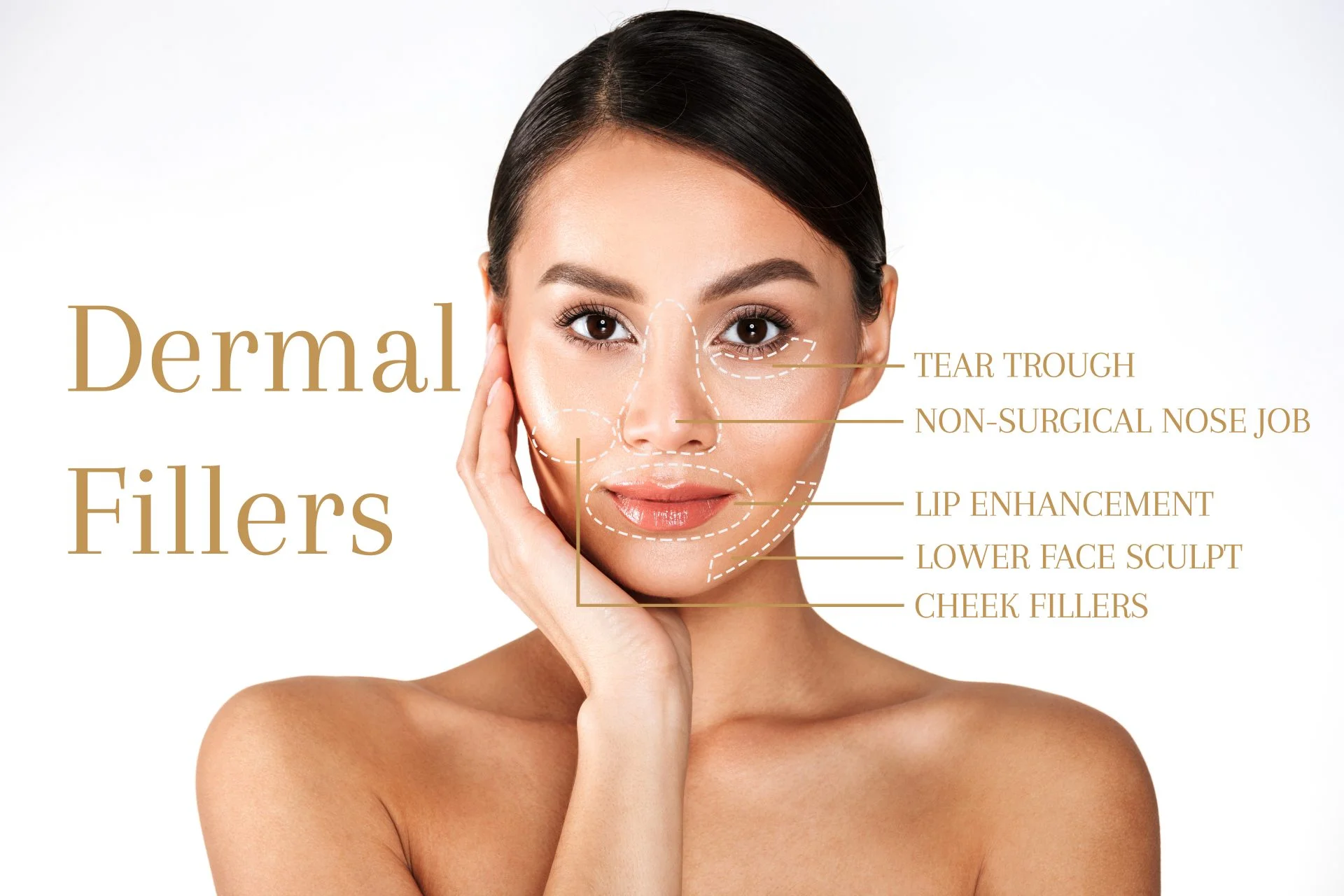 The Longevity of Dermal Fillers