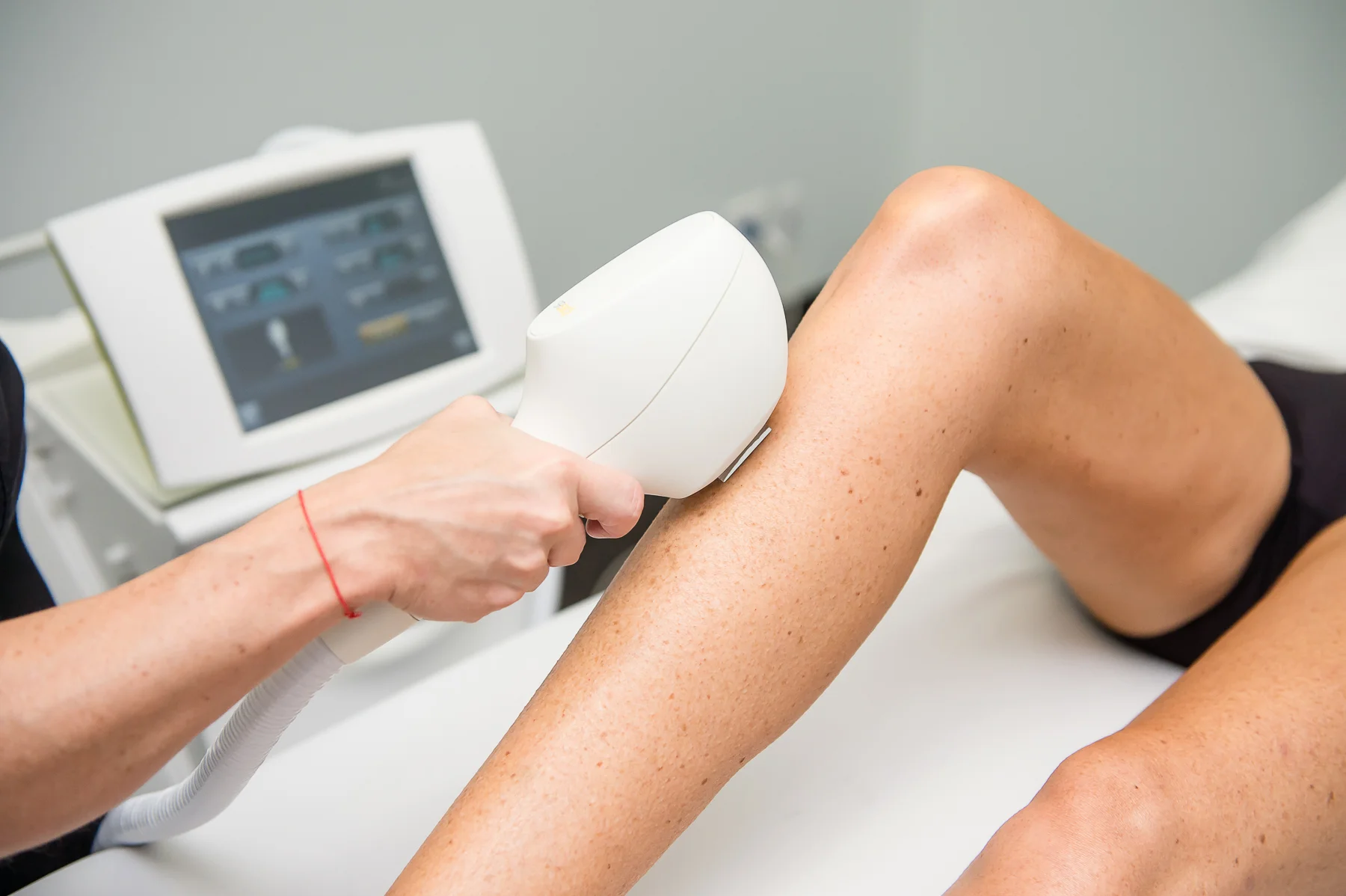 Laser Hair Removal Bristol: Long-Term Smoothness